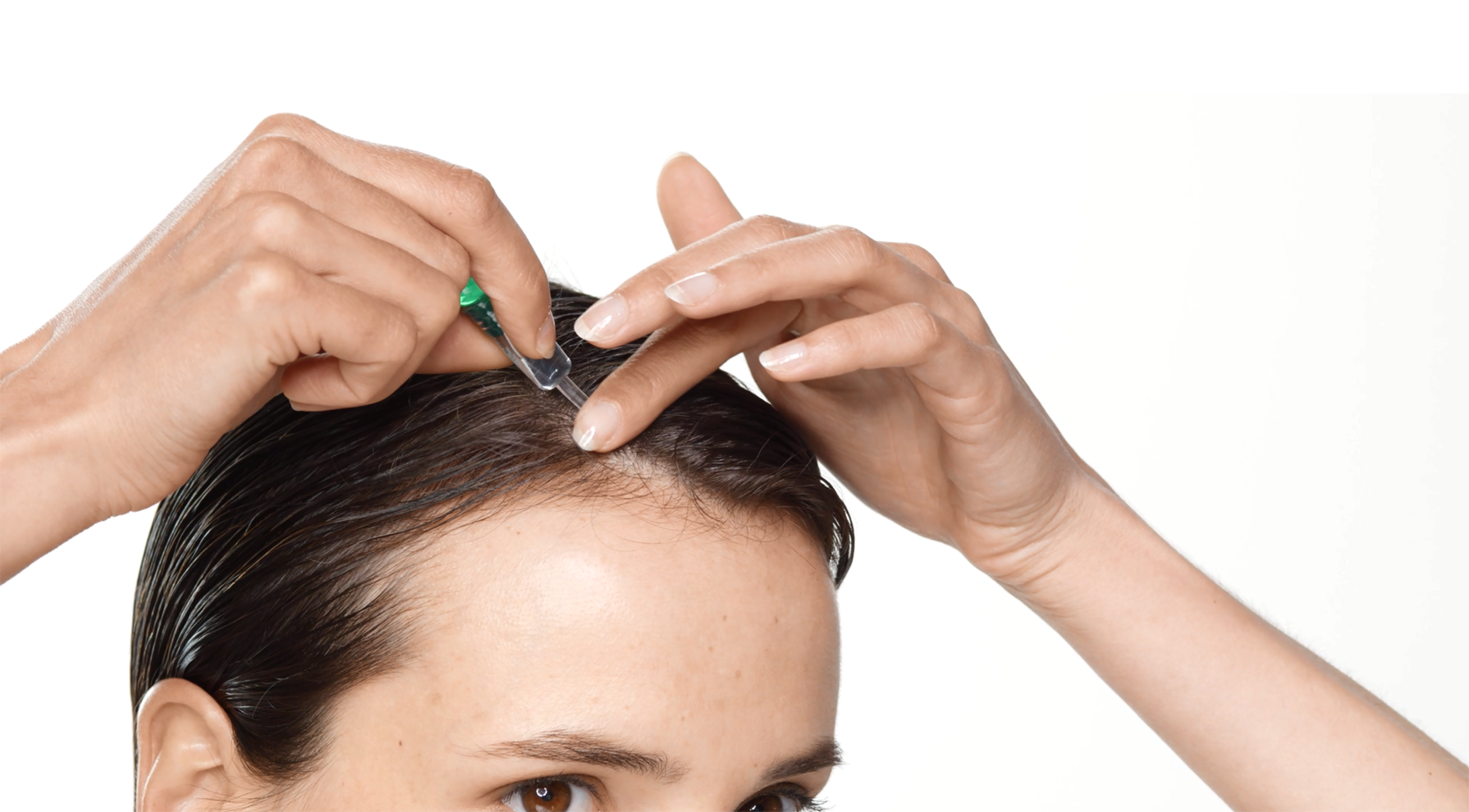 Behandlung von temporärem Haarausfall Behandlung von temporärem Haarausfall